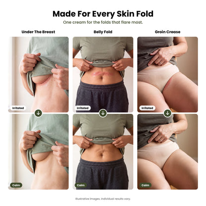 Skin Fold Rash Relief Cream