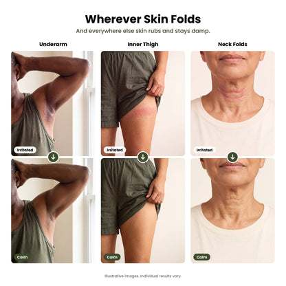 Skin Fold Rash Relief Cream